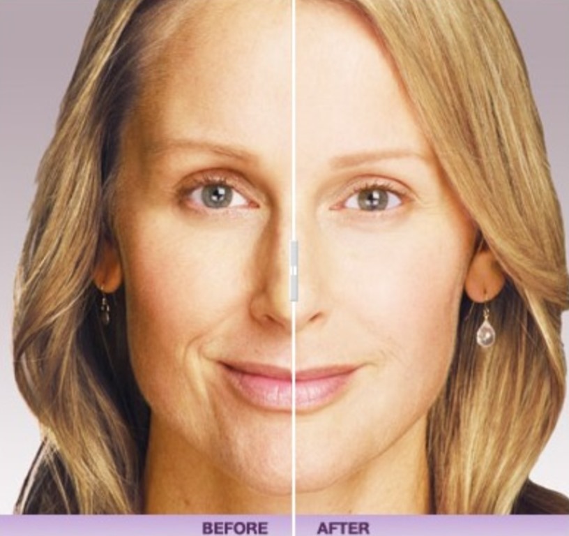 Read more about the article Interviews With Experts: Skin Care Specialist Jenny Cajucom On Fillers